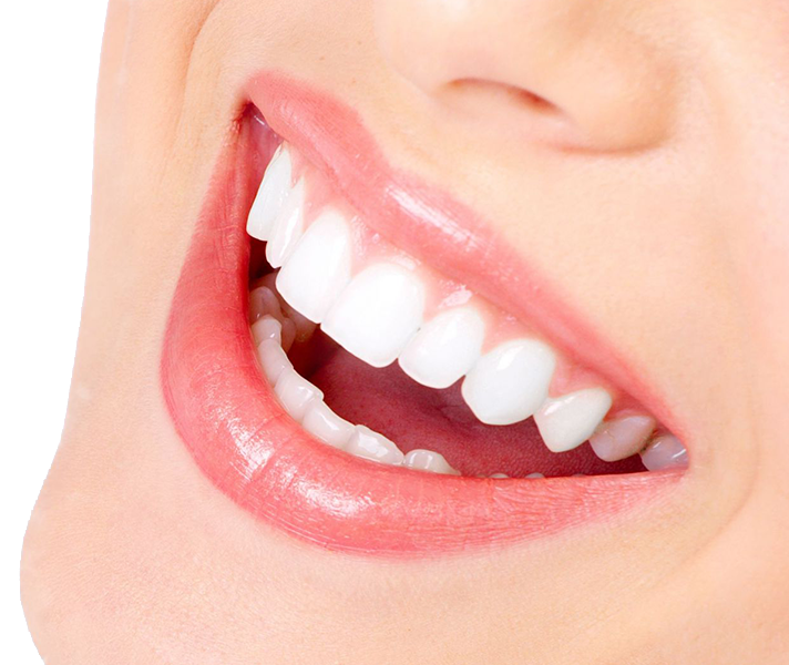 ابتسامة هوليوود — THCG Dental Clinic